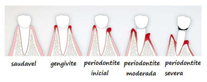 Essa imagem tem um atributo alt vazio; o nome do arquivo Ã© perio-desenho.png